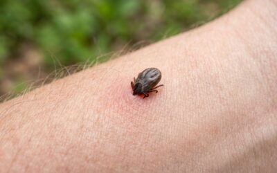 Kleszcz na skórze – co zrobić, by usunąć go bezpiecznie?